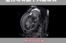 胎儿胎教时不动是怎么回事