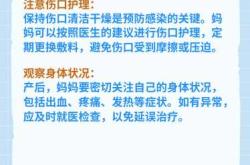 如何关键词择吉剖腹产