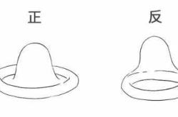 备孕能剪套套洞吗