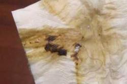 产后两个月有褐色分泌物正常吗