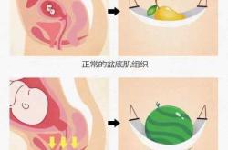 顺产后阴道会松吗