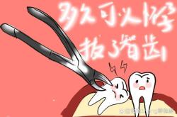 备孕是不是都要拔智齿