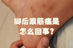 产后脚筋疼是怎么回事