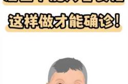 断掌的婴儿意味着什么