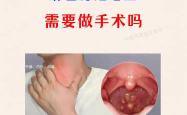 产后慢性咽炎该怎么办