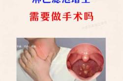 产后慢性咽炎该怎么办