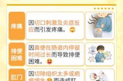 切痔疮后多久可以开始备孕