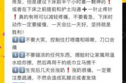 剖腹产手术准备需注意什么