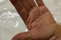 产后留黄东西究竟是怎么回事