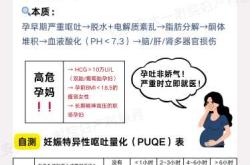 孕30周孕反更严重怎么回事