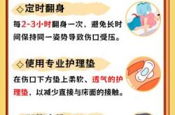 剖腹产后几天不疼呢