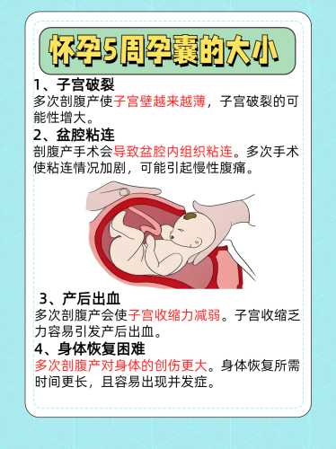 剖腹产要做盆底检查吗-第1张图片