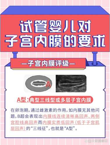 试管婴儿为什么会生化-第1张图片