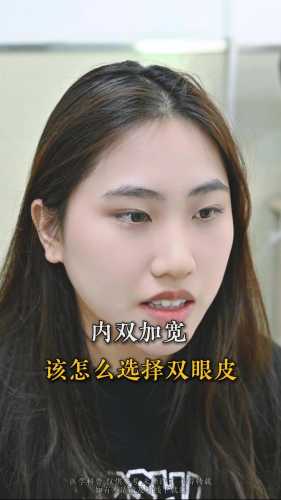 新生儿内双会变外双吗-第1张图片