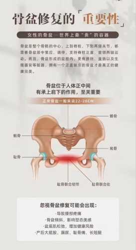 产后如何有效收髋骨-第1张图片