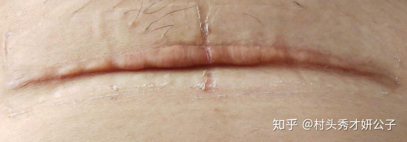 惠安妇幼剖腹产情况如何-第1张图片