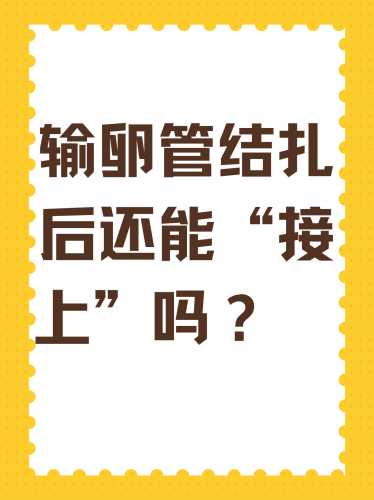 剖腹产可以顺便结扎吗-第1张图片
