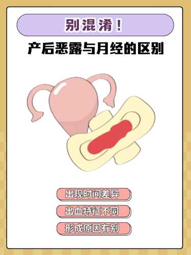 产后十几天恶露变多是咋回事-第1张图片