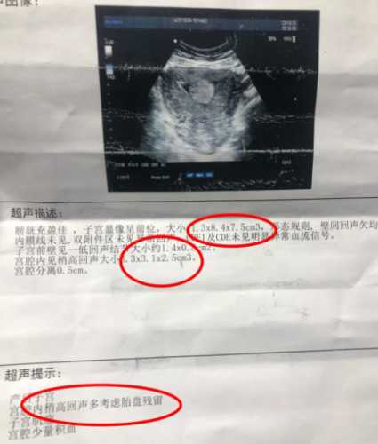 产后流血一般几天干净-第1张图片
