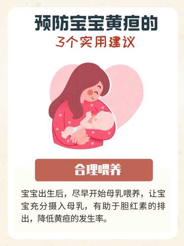 新生儿黄疸14怎么办-第1张图片