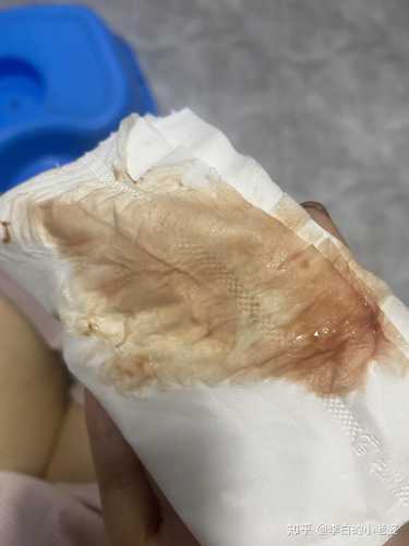 人工流产后一直有点血正常吗-第1张图片
