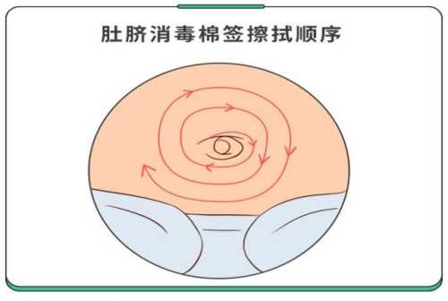 新生儿尿不湿如何护理肚脐-第1张图片