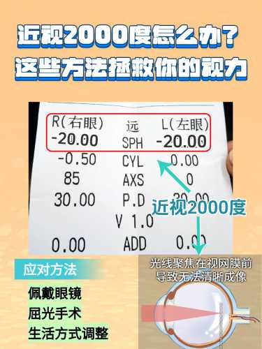 多少度近视影响顺产吗-第1张图片