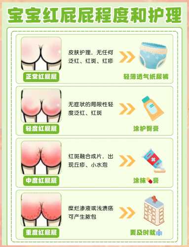 新生儿红屁股怎么有效护理-第1张图片