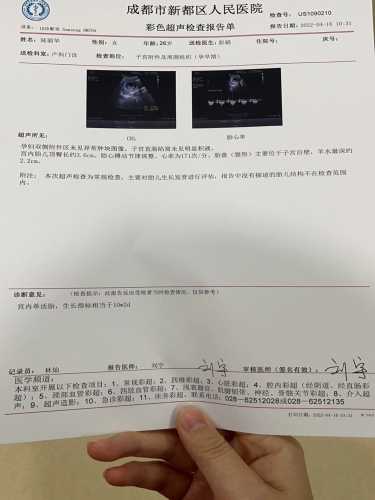 孕10周妈妈孕反情况如何-第1张图片