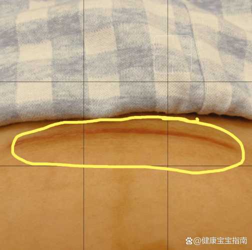 剖腹产针伤口会有啥问题-第1张图片