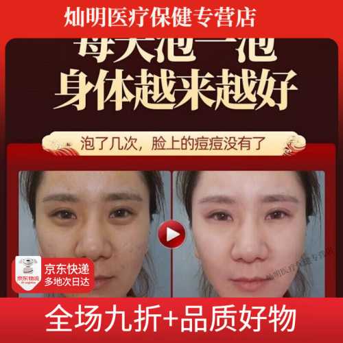产后风发汗真的有效果吗-第1张图片