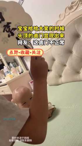 婴儿卤门有哪些注意事项-第1张图片