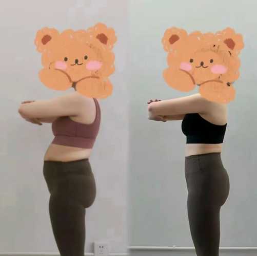 产后肚子恢复过程图有吗-第1张图片