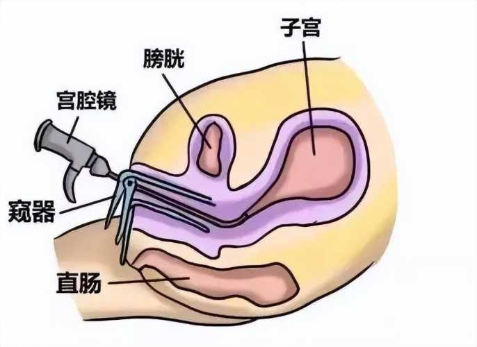 膀胱壁厚0.8能备孕吗-第1张图片