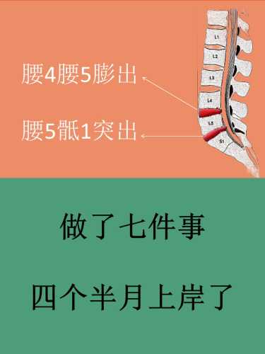 产后腰痛多久能恢复-第1张图片