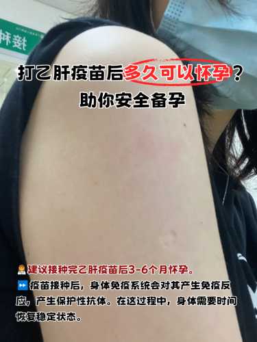疫苗打完两针后多久能备孕-第1张图片