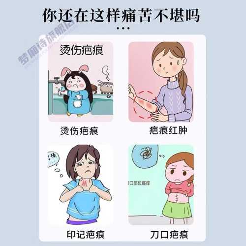 剖腹产腿痒是怎么回事-第1张图片