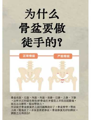 产后如何评估盆骨状态-第1张图片
