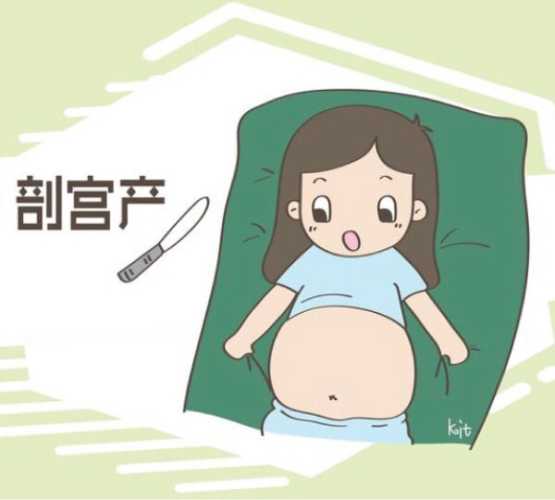 剖腹产要不要特意算日子-第1张图片