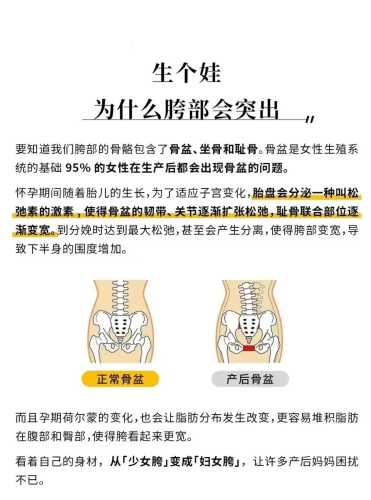 产后修复骨盆最佳时间何时-第1张图片