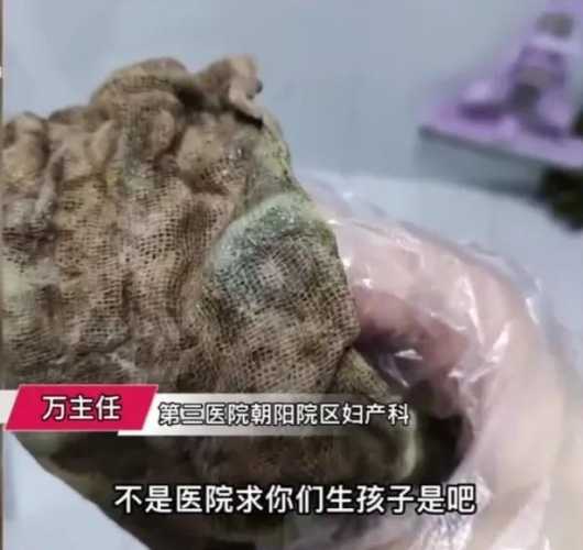 医院主张顺产背后有何原因-第1张图片