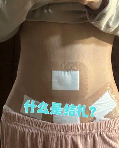 结扎后还能再怀孕吗-第1张图片