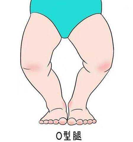 婴儿不自觉腿抖是怎么回事-第1张图片
