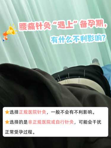 备孕前要做什么理疗-第1张图片