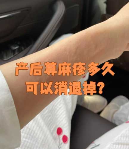 产后感染会有哪些症状呢-第1张图片