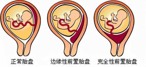 备孕前需要做脑磁共振吗-第1张图片