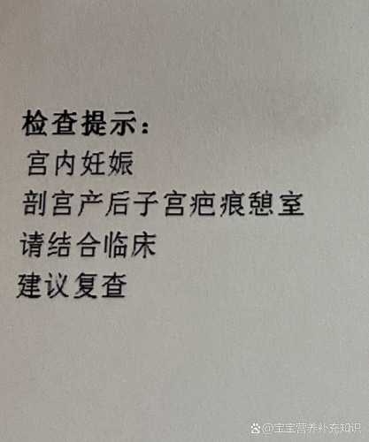 一胎剖腹产二胎能顺产吗-第1张图片