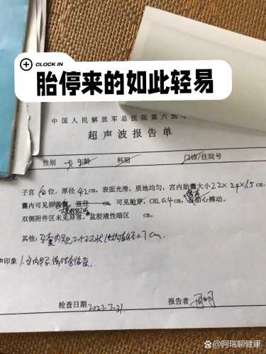 孕反大便稀疏怎么办-第1张图片