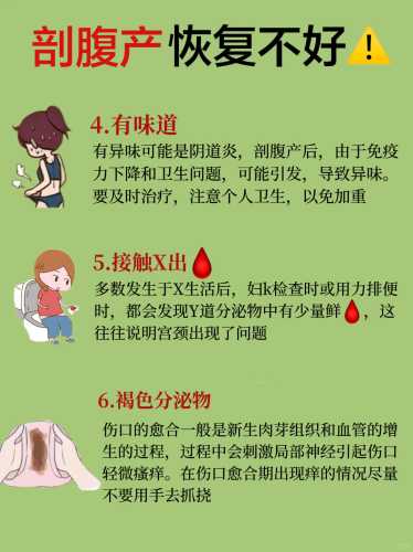 剖腹产会导致松弛吗-第1张图片