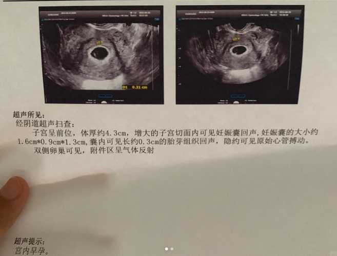 什么时候能查出怀孕-第1张图片
